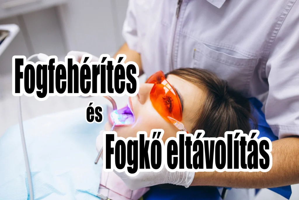 A fogkőleszedés és fogfehérítés olyan alapvető kezelések, amelyek nemcsak a megjelenést javítják, hanem hozzájárulnak a szájüreg egészségéhez is
