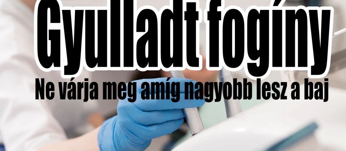 Gyulladt fogíny kezelésének fontossága megkérdőjelezhetetlen.